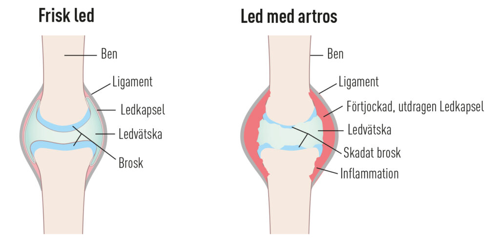 Led med artros